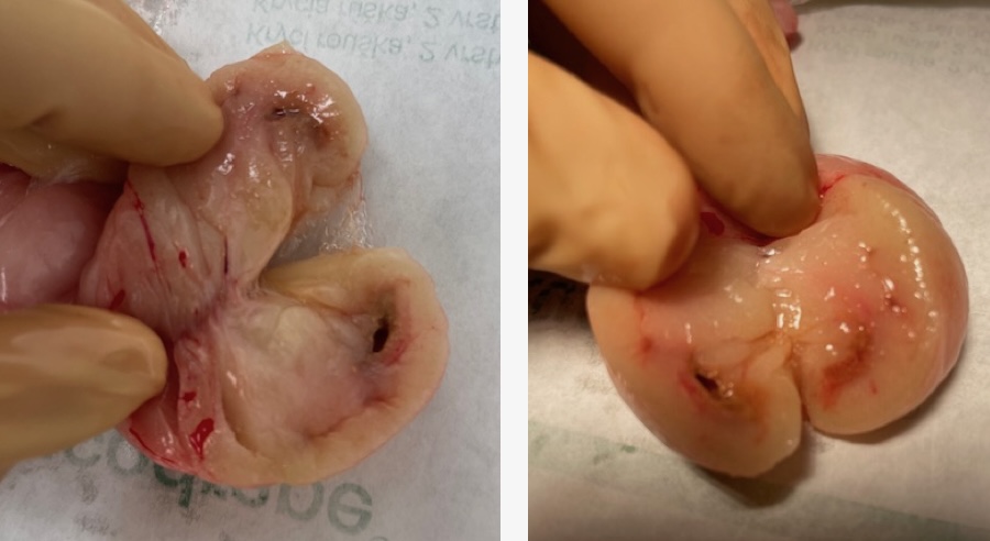 Nodules chirurgie lapine
